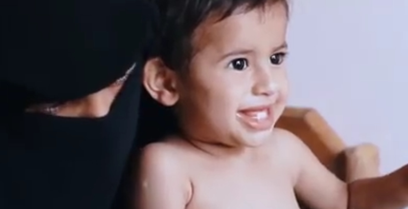 Success Story: The Child Hanadi …The pain that turned into hope UNICEF Yemen HUMAN ACCESS